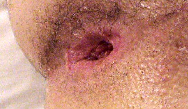 Freshly fucked ass hole gaping open