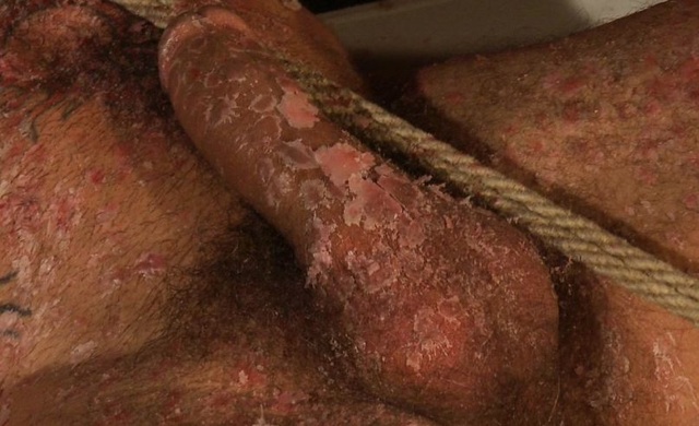 Alessios wax covered cock